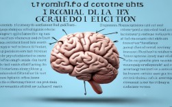 脑梗死日常小常识有哪些要点需牢记？