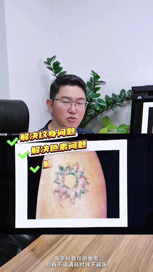 疤痕影响国考报名吗？-图2