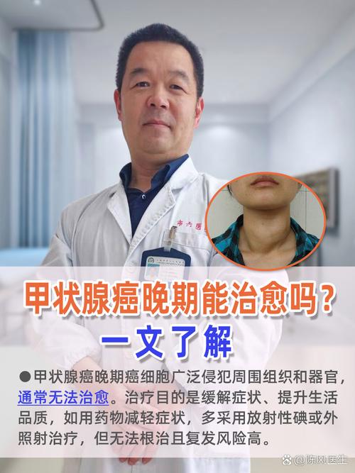 甲状腺癌国考是什么？为何要考？-图3