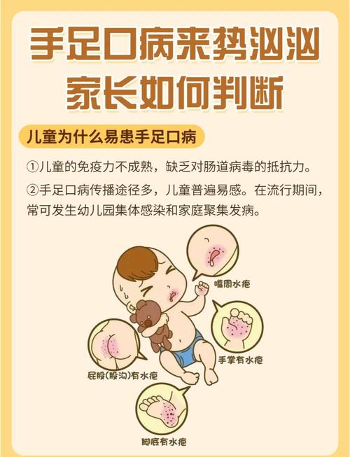 手足口病高发季，如何科学预防才能有效保护孩子健康？-图1